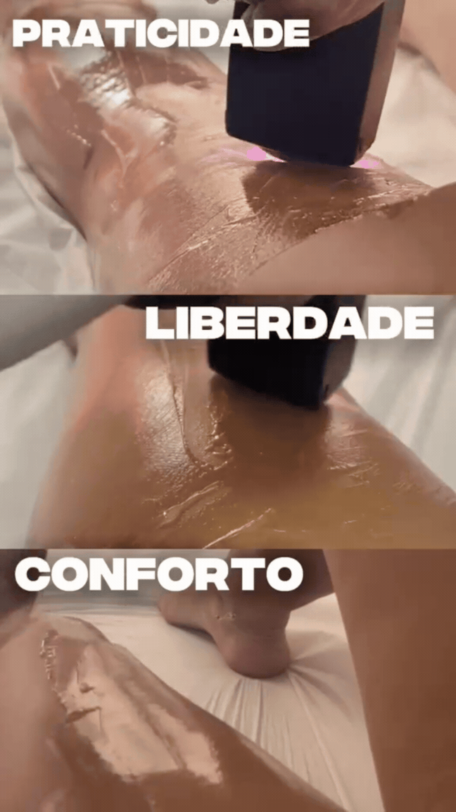 Demonstração de depilação a laser